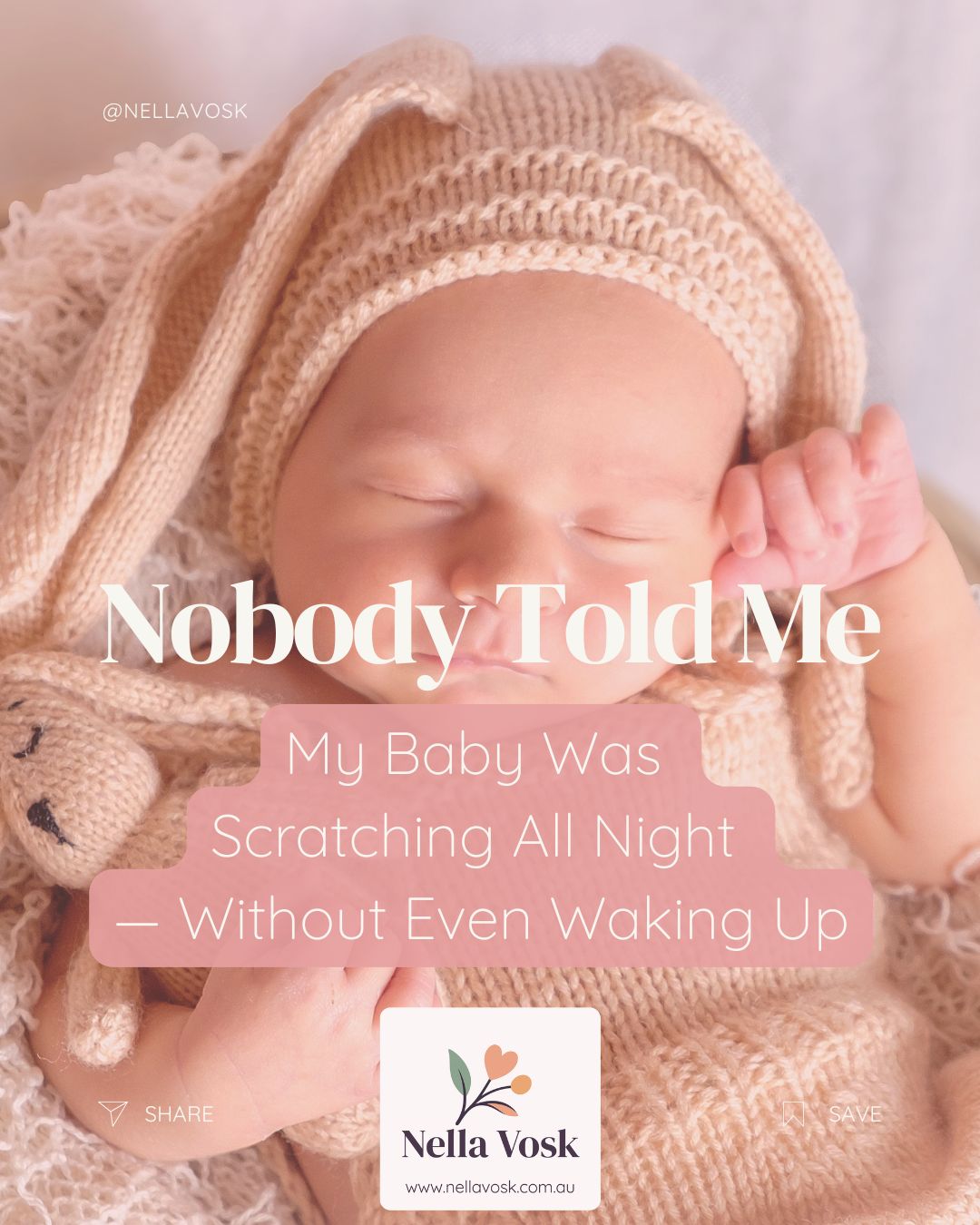 Nobody Told Me My Baby Was Scratching All Night — Without Even Waking Up