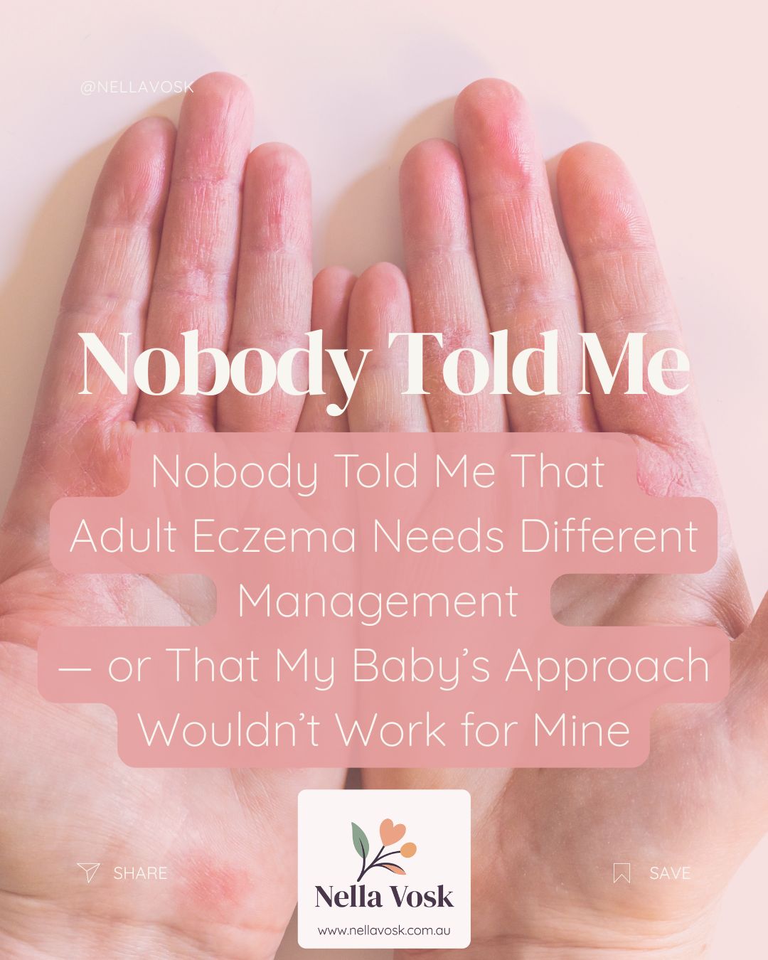 Nobody Told Me That Adult Eczema Needs Different Management — or That My Baby’s Approach Wouldn’t Work for Mine