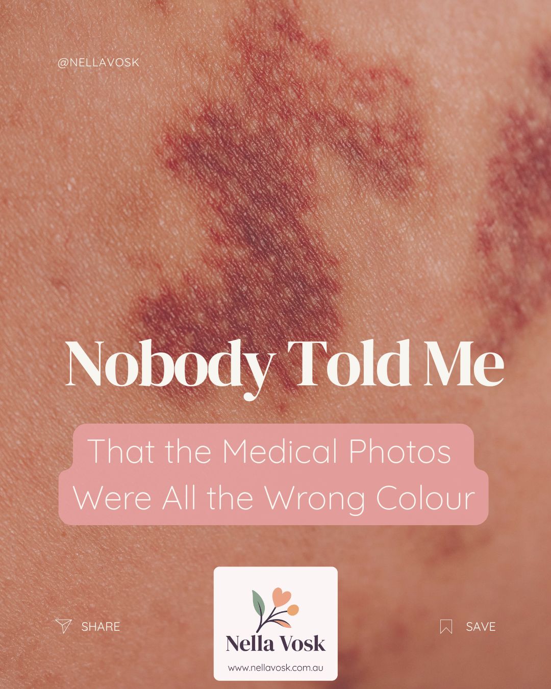 Nobody Told Me That the Medical Photos Were All the Wrong Colour