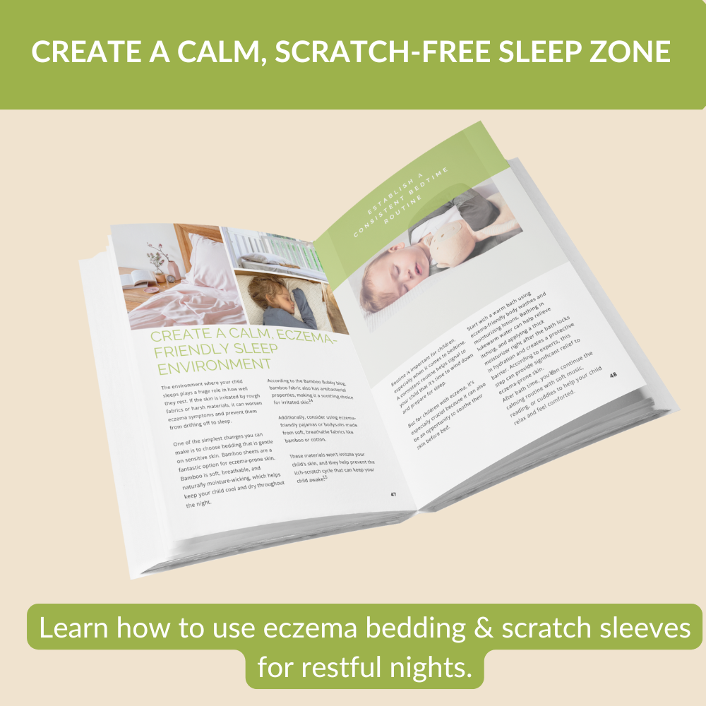 Ending the Eczema Itch Cycle: A Practical Guide to Helping Your Kids Survive the Eczema Epidemic (Paperback)