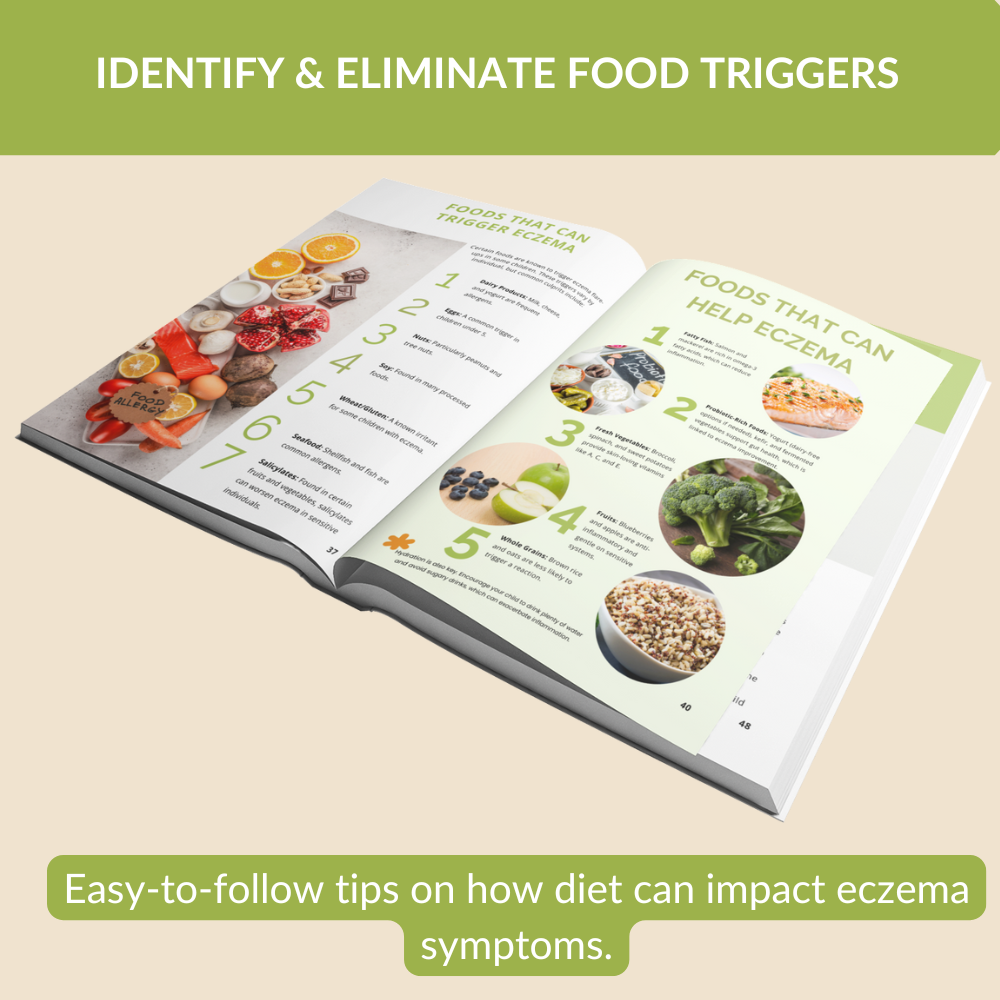 Ending the Eczema Itch Cycle: A Practical Guide to Helping Your Kids Survive the Eczema Epidemic (Paperback)