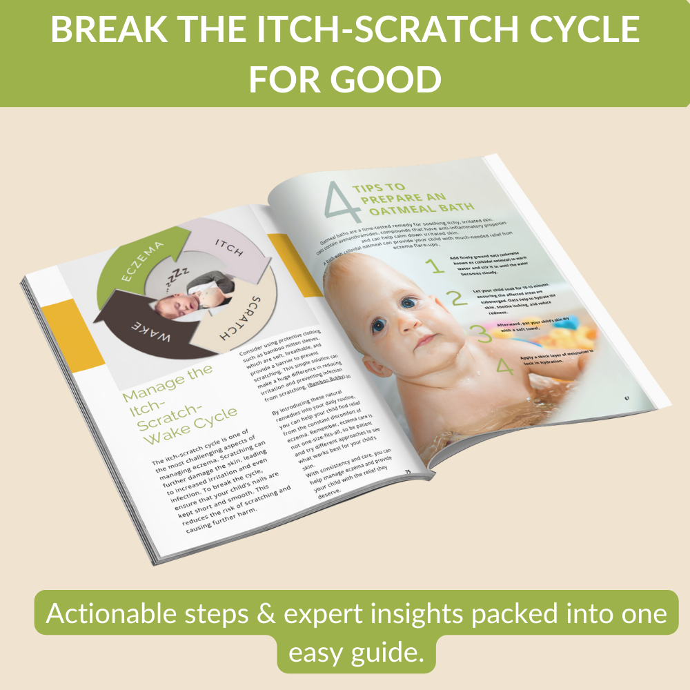 Ending the Eczema Itch Cycle: A Practical Guide to Helping Your Kids Survive the Eczema Epidemic (Paperback)