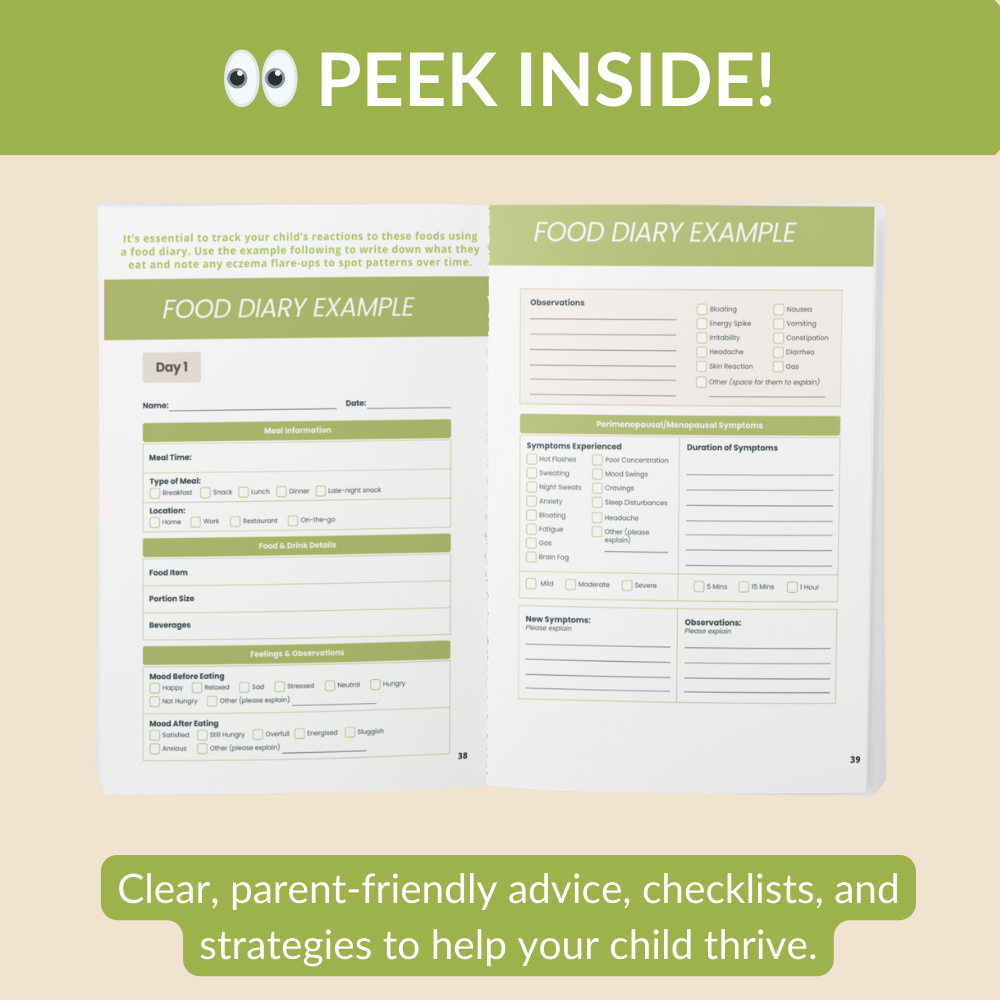 Ending the Eczema Itch Cycle: A Practical Guide to Helping Your Kids Survive the Eczema Epidemic (Paperback)